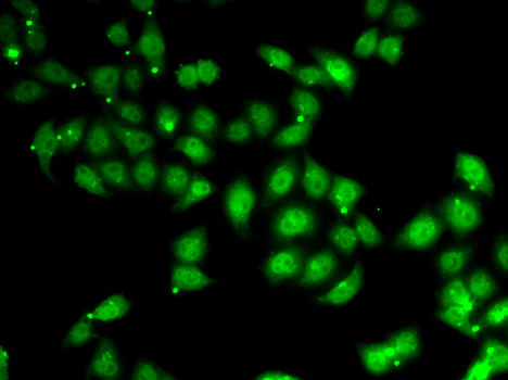 AFF1 Polyclonal Antibody