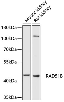 RAD51B Polyclonal Antibody