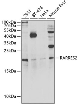 RARRES2 Polyclonal Antibody