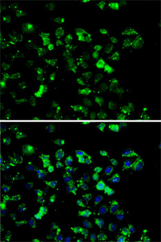 RBBP6 Polyclonal Antibody