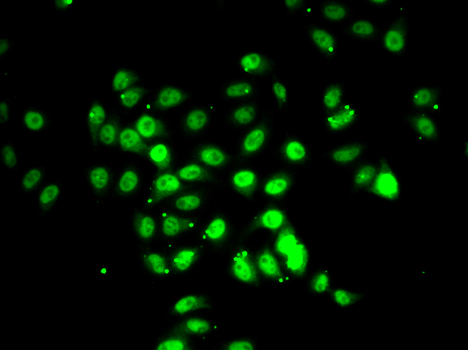RFX5 Polyclonal Antibody