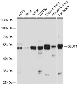GLUT1 Rabbit Polyclonal Antibody