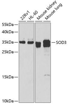 SOD3 Polyclonal Antibody