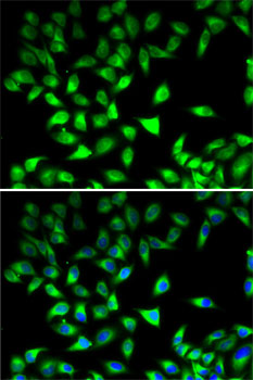 STAT4 Rabbit Polyclonal Antibody