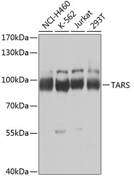TARS Polyclonal Antibody