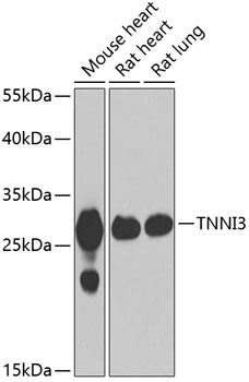 TNNI3 Rabbit Polyclonal Antibody