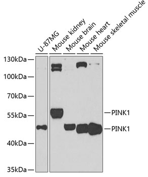 PINK1 Rabbit Polyclonal Antibody