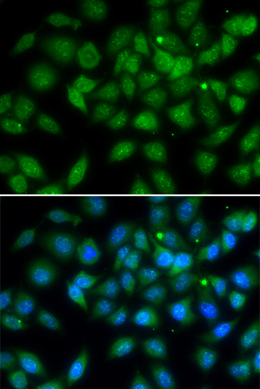 LELP1 Polyclonal Antibody