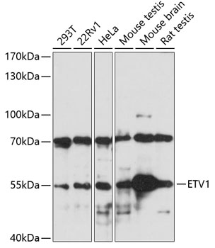 ETV1 Polyclonal Antibody