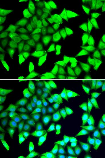 HDAC5 Rabbit Polyclonal Antibody
