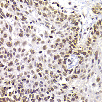 PHIP Polyclonal Antibody