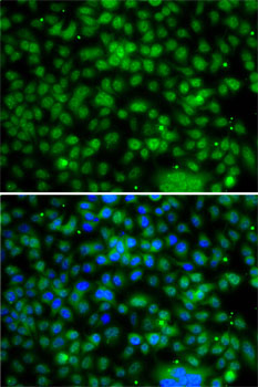 PHYHD1 Polyclonal Antibody