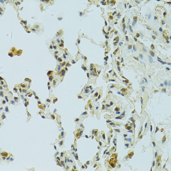 RSRC1 Polyclonal Antibody