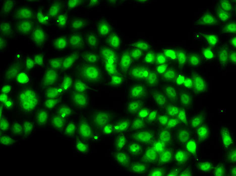 SETBP1 Polyclonal Antibody