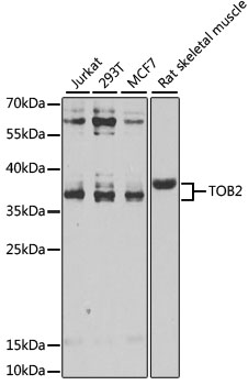 TOB2 Polyclonal Antibody