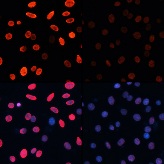 Acetyl-Histone H3-K18 pAb