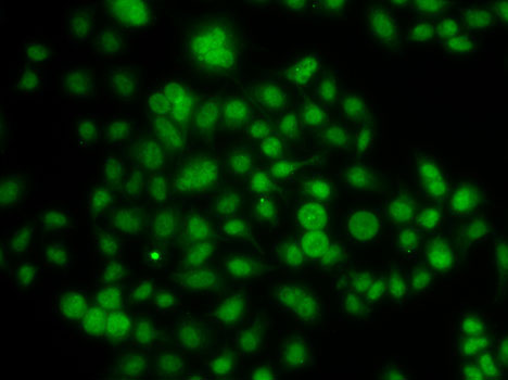 ATOH7 Polyclonal Antibody