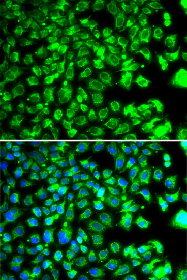 C10orf32 Polyclonal Antibody