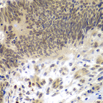 CEBPG Rabbit Polyclonal Antibody