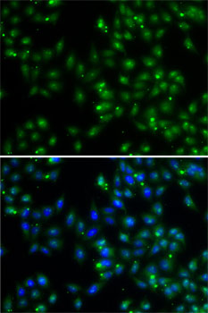 DUSP22 Rabbit Polyclonal Antibody