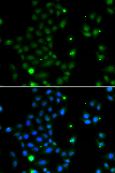 GCM1 Polyclonal Antibody