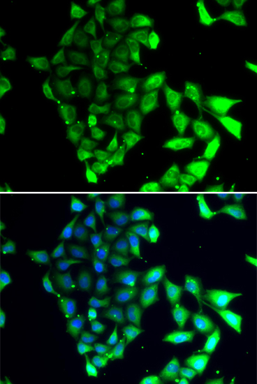 MID1 Polyclonal Antibody