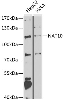 NAT10 Rabbit Polyclonal Antibody