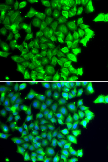 TRIAP1 Polyclonal Antibody
