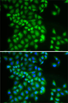 YTHDC1 Polyclonal Antibody