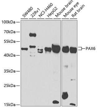 PAX6 Rabbit Polyclonal Antibody