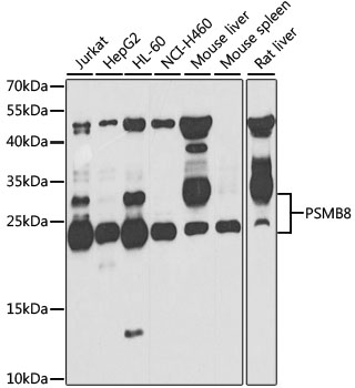 PSMB8 Rabbit Polyclonal Antibody