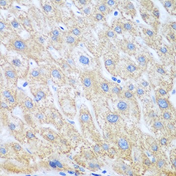 PTGS1 Rabbit Polyclonal Antibody