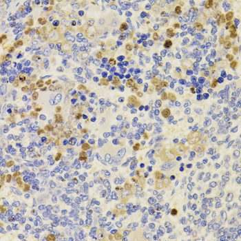 PRDM5 Rabbit Polyclonal Antibody