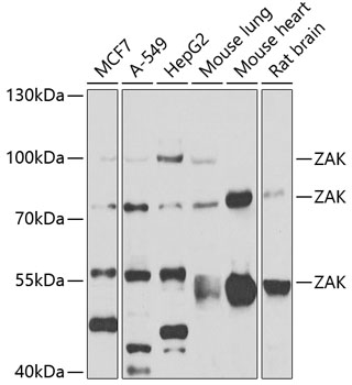ZAK Rabbit Polyclonal Antibody