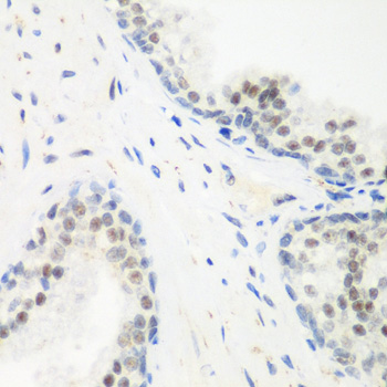 PPAN Polyclonal Antibody