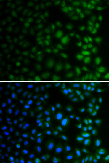 NAA40 Polyclonal Antibody