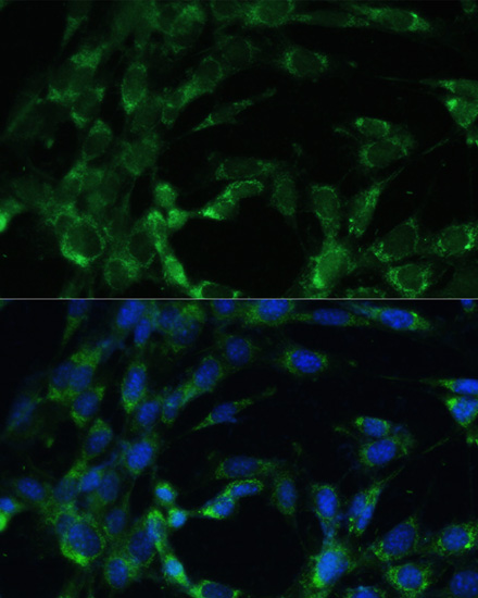 BCAT2 Rabbit Polyclonal Antibody