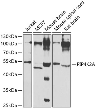 PIP4K2A Rabbit Polyclonal Antibody