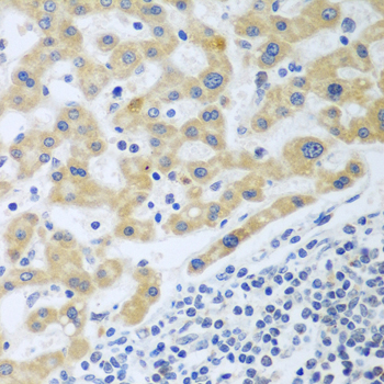 SHBG Rabbit Polyclonal Antibody