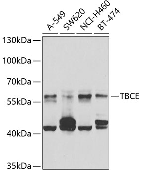 TBCE Polyclonal Antibody