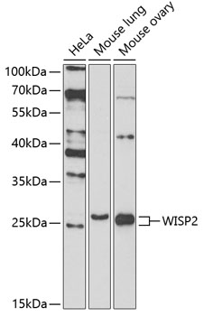 WISP2 Rabbit Polyclonal Antibody