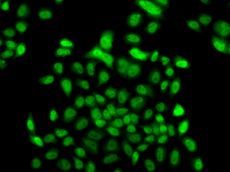 FBXO7 Polyclonal Antibody