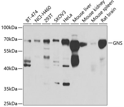 GNS Polyclonal Antibody