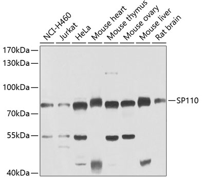 SP110 Polyclonal Antibody
