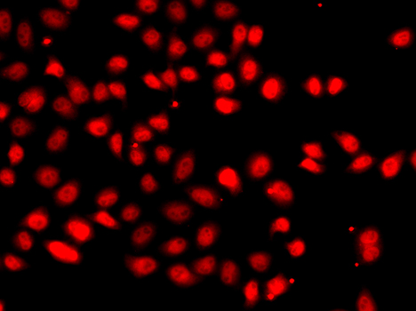 HIF2A Rabbit Polyclonal Antibody