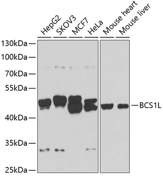 BCS1L Polyclonal Antibody