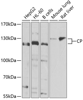 CP Rabbit Polyclonal Antibody