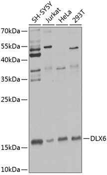 DLX6 Polyclonal Antibody