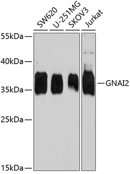 GNAI2 Rabbit Polyclonal Antibody