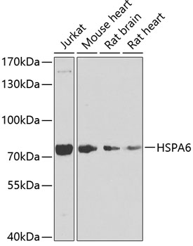 HSPA6 Polyclonal Antibody